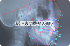 矯正専門機器の導入